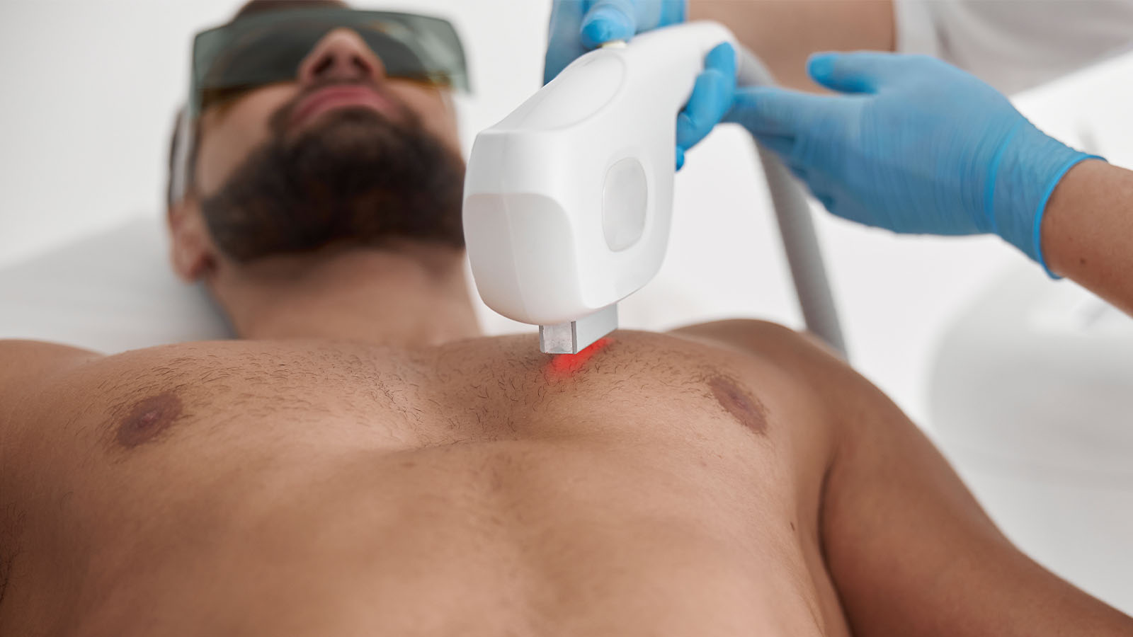 Laser hair removal for men