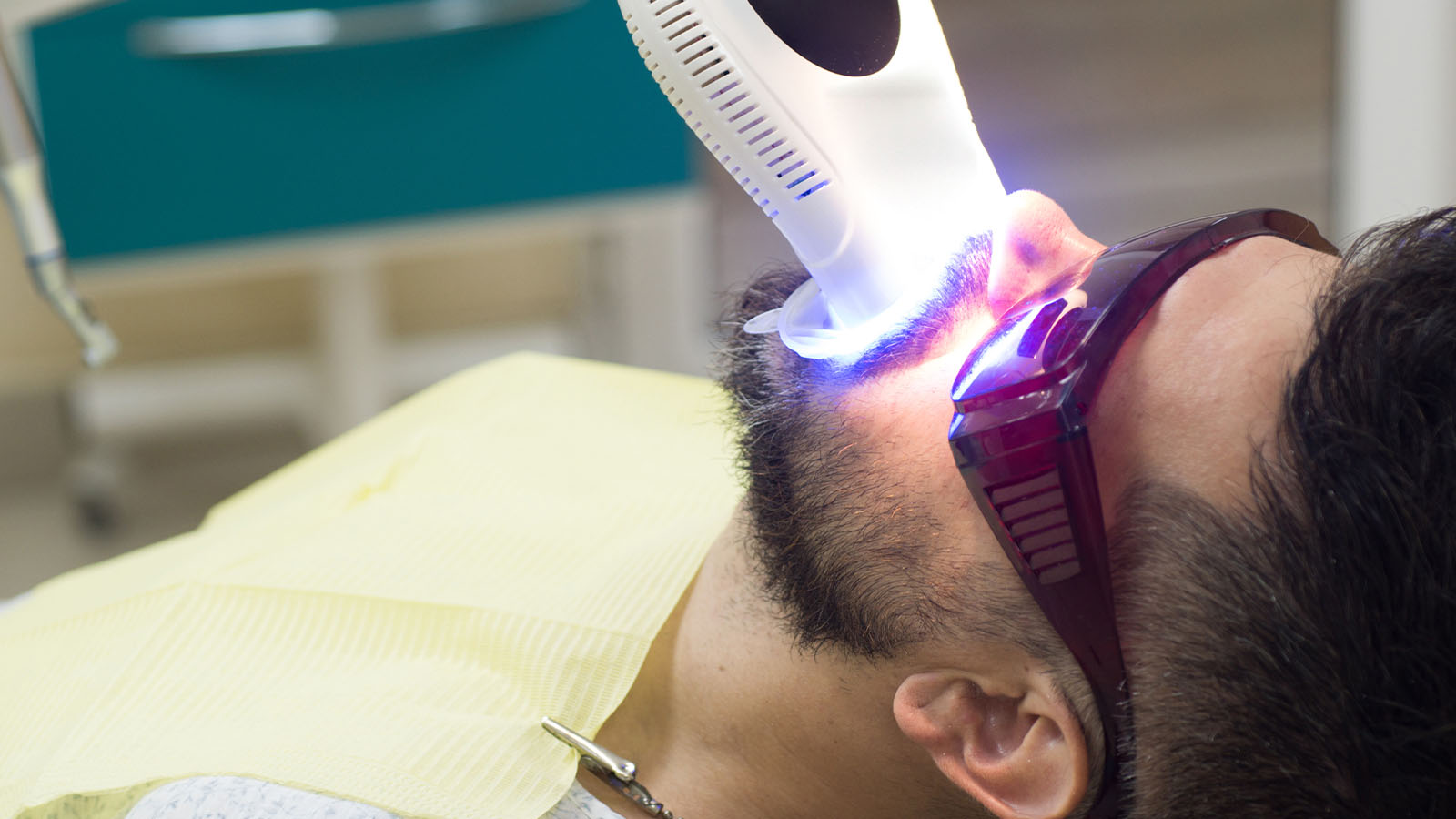 Huidverzorging Rotterdam - Tanden Bleken voor mannen